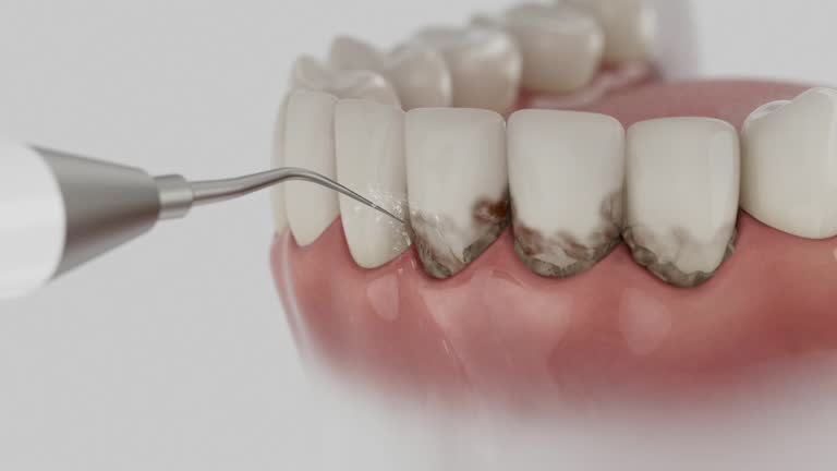Trusted Teeth Whitening service in Salado, TX - Dentist Open Now